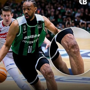 开云赛事-好可怕的膝盖！两次ACL撕裂，他还在打球！！！